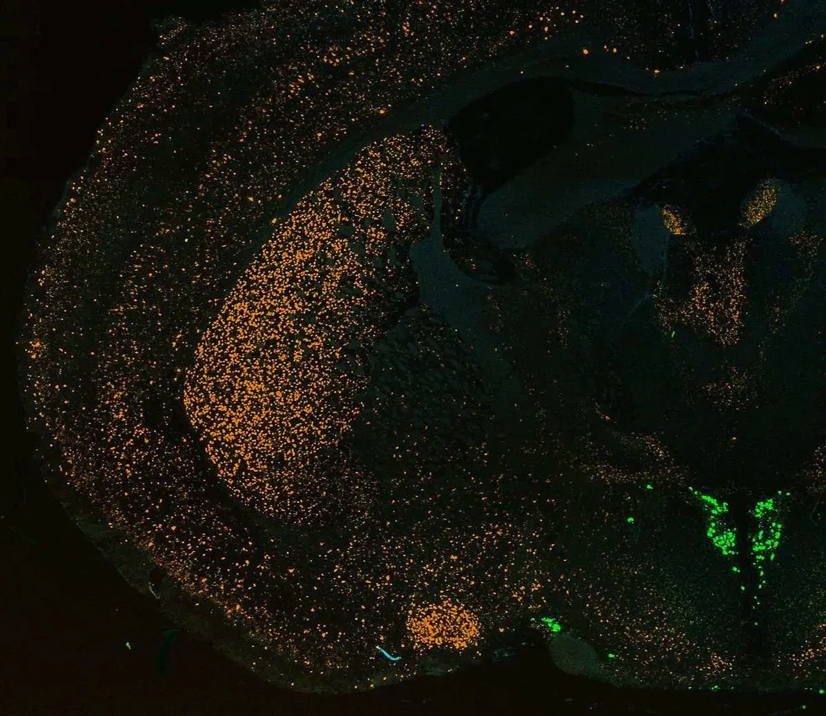 Fluorescence micrograph of a brain section from the maternal-brain project