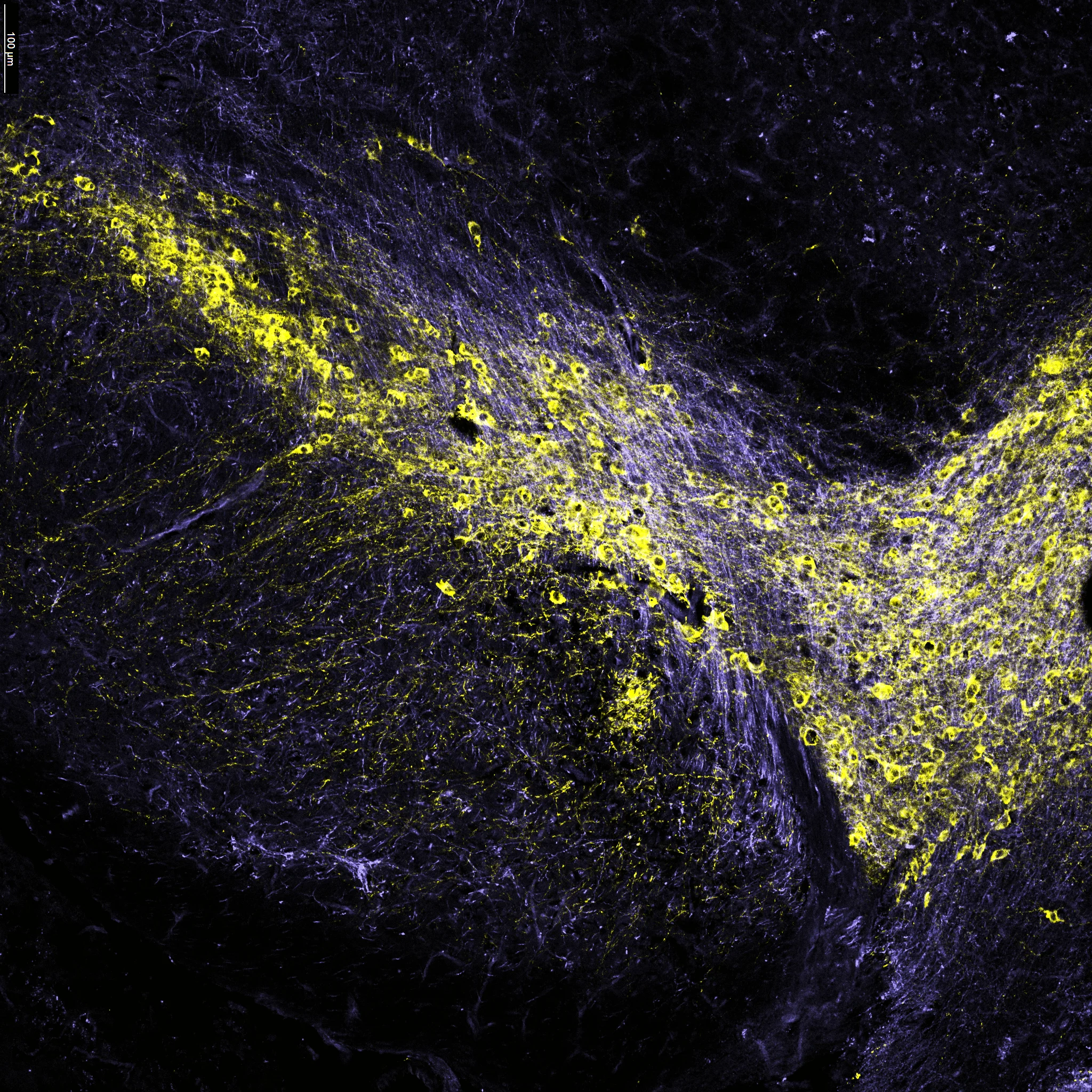 Ventral tegmental area of the mouse brain: TH-positive dopamine neurons in yellow among ChR2-expressing striatal inputs in violet